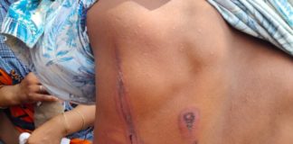 घर में घुसकर दबंगों ने महिला और बच्चों से की मारपीट, पुलिस पर FIR न दर्ज करने का परिजनों ने लगाया आरोप